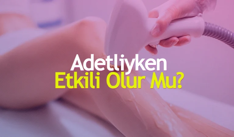 Adetliyken Lazer Epilasyon Etkili Olur Mu