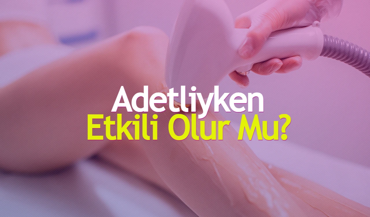 Adetliyken Lazer Epilasyon Etkili Olur Mu